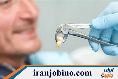 متخصص جراحی دندان عقل در مفتح تهران