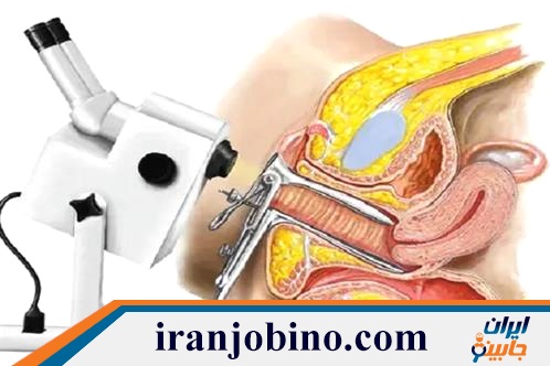 متخصص کولپوسکوپی در مرادآباد تهران