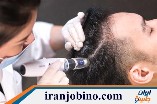 کلینیک مزوتراپی مو در پاسداران و ضرابخانه تهران