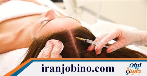 کلینیک مزوتراپی مو در پاسداران و ضرابخانه تهران