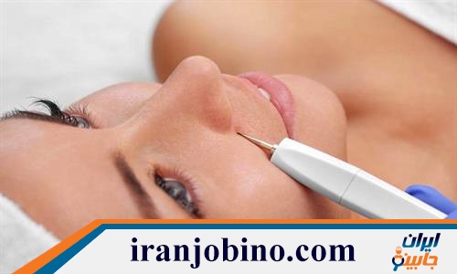 کلینیک برداشتن خال و زگیل در شمال تهران 