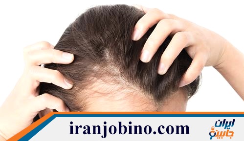 دکتر و کلینیک پی آر پی مو در تهرانپارس شرقی 