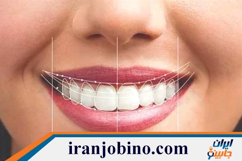 دندانپزشک زیبایی در شمیران نو تهران