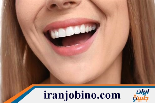 دندانپزشک زیبایی در شمیران نو تهران