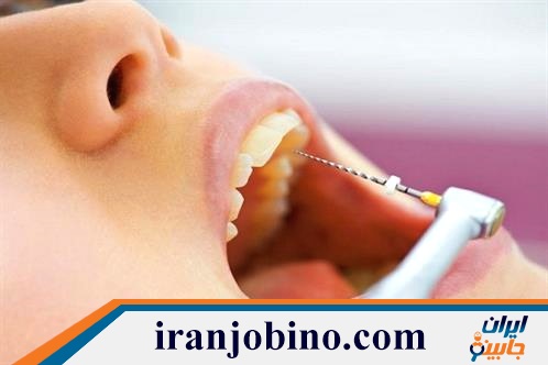 متخصص عصب کشی دندان در خیابان کاشان تهران