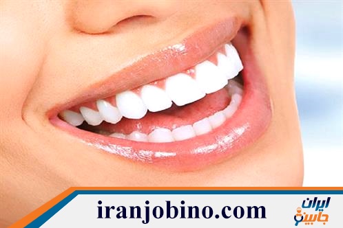 متخصص بلیچینگ دندان در خانی آباد نو تهران
