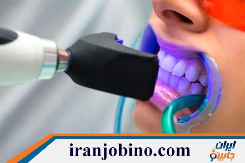 متخصص بلیچینگ دندان در جهاد تهران
