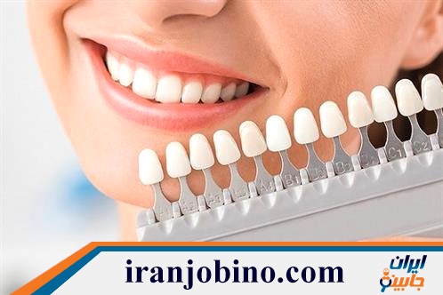 متخصص لمینت دندان در جمهوری تهران