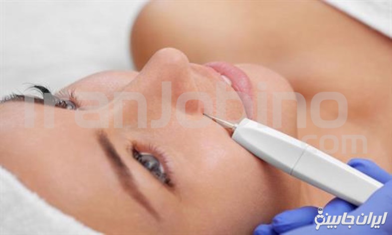 خطرات و عوارض جانبی در ارتباط با برداشتن خال یا زگیل