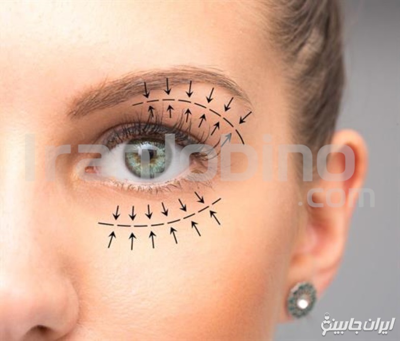 ویژگی های بهترین کلینیک بلفاروپلاستی