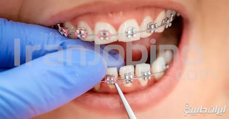 مزایای مراجعه به متخصص ارتودنسی