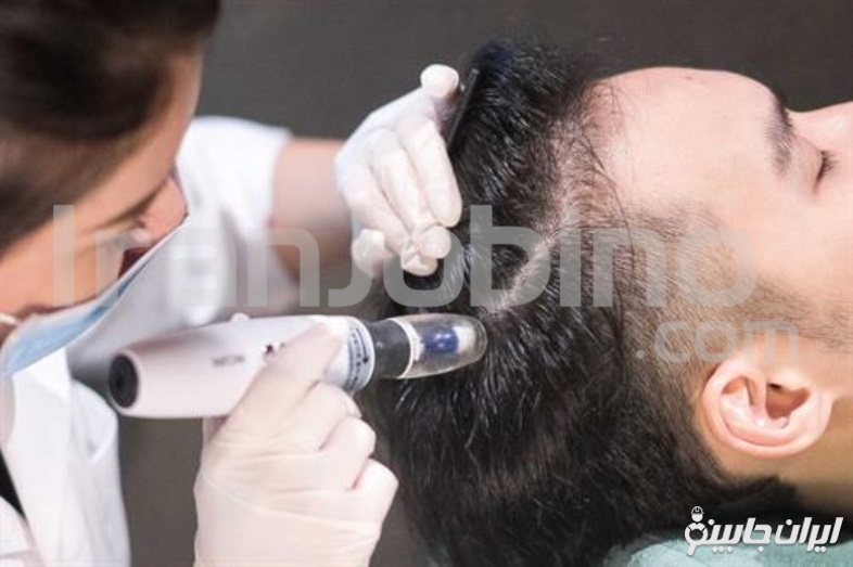 ویژگی های بهترین کلینیک مزوتراپی مو