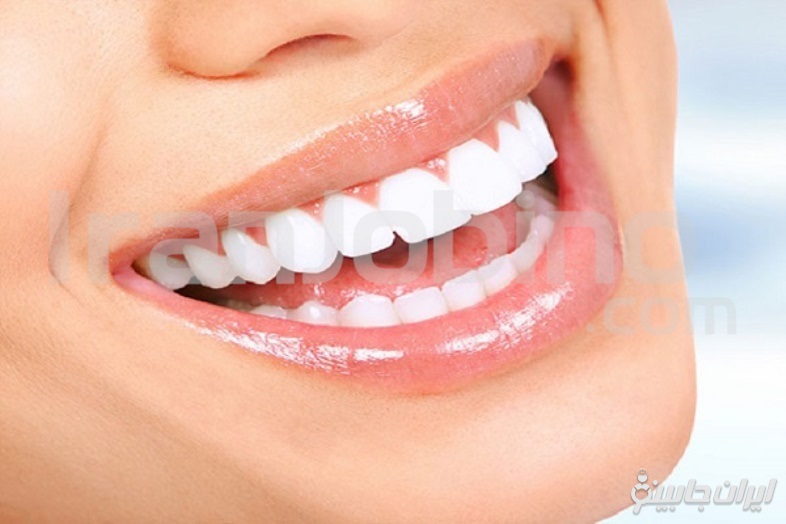 بلیچینگ دندان