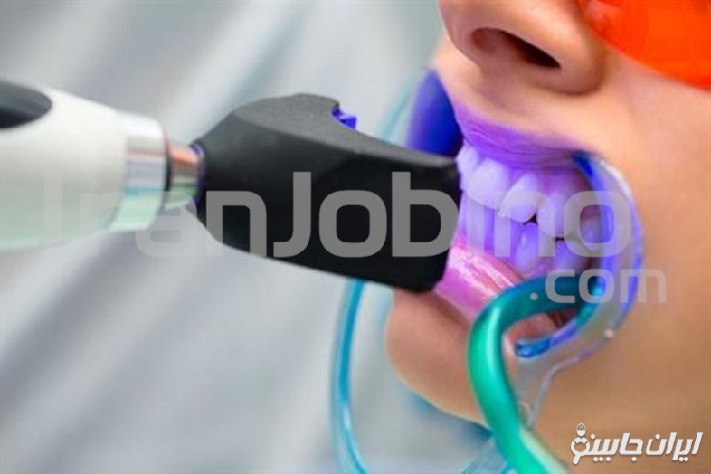 ویژگی های بهترین مرکز بلیچینگ دندان