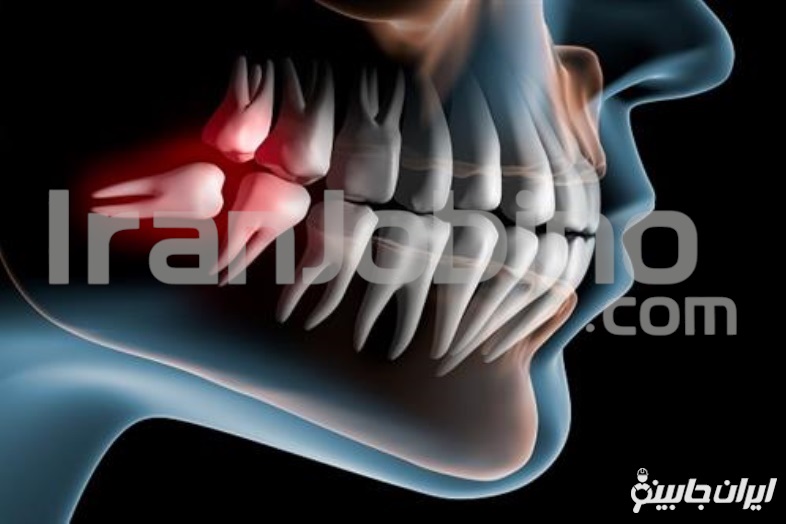 ویژگی های بهترین مرکز جراحی دندان عقل