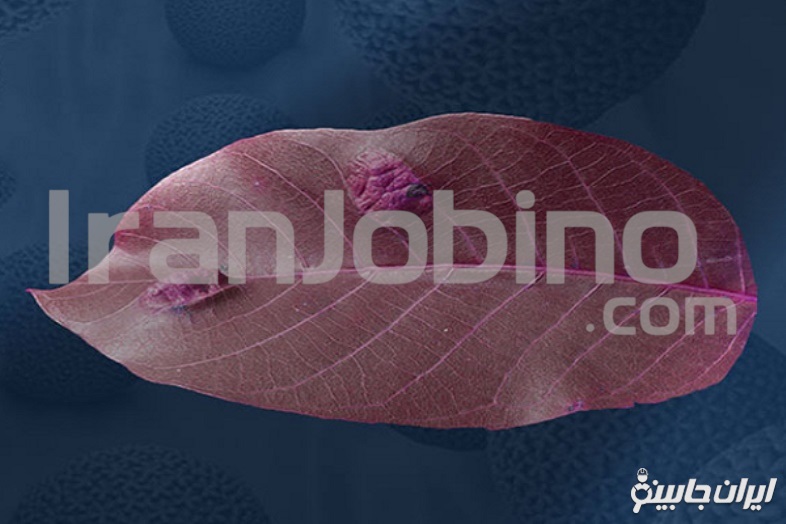 زگیل تناسلی چه مدت بعد از رابطه مشخص می شود؟