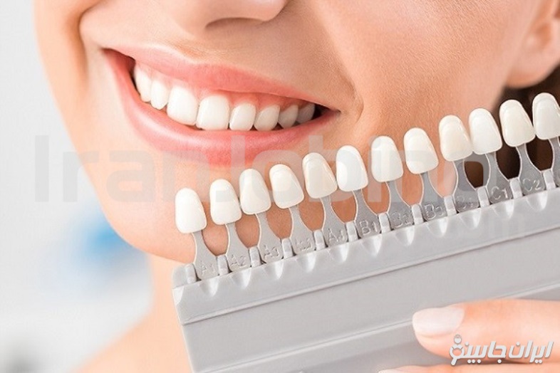 ویژگی های بهترین مرکز لمینت دندان