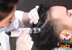 کلینیک مزوتراپی مو در پاسداران و ضرابخانه تهران