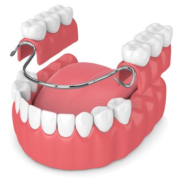 انواع خدمات دندانپزشکی زیبایی و ترمیمی