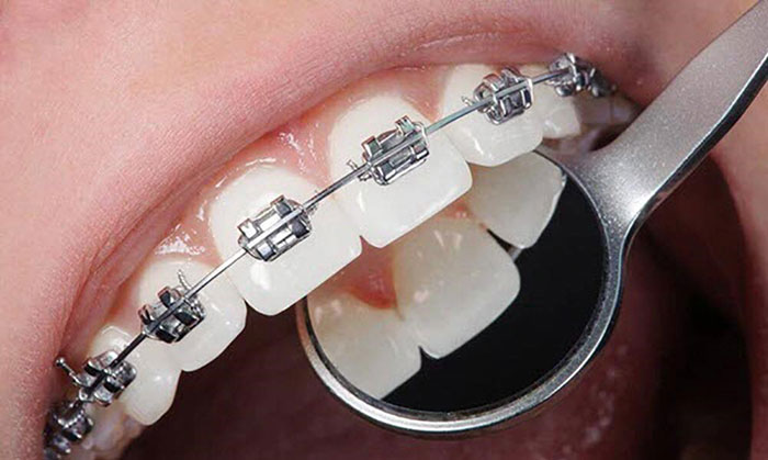 انواع خدمات دندانپزشکی زیبایی و ترمیمی