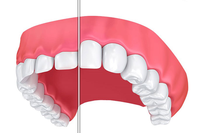 انواع خدمات دندانپزشکی زیبایی و ترمیمی
