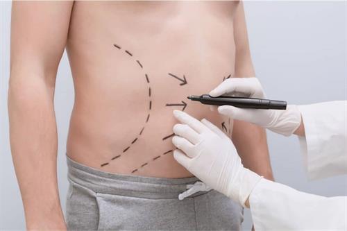 خدمات لاغری موضعی حرفه‌ ای برای شکل دهی بدن