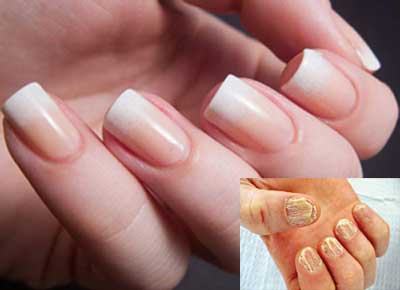 همه چیز در خصوص کاشت ناخن