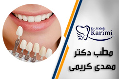 مطب دکتر مهدی کریمی گروه دندانپزشک زیبایی - ایمپلنت - ایران جابینو