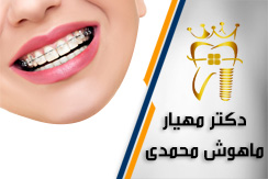 مطب ارتودنسی دکتر ماهوش محمدی گروه متخصص ارتودنسی و ناهنجاری های فکی (اقساطی) - ایران جابینو