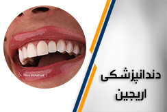 مجموعه تخصصی دندانپزشکی اریجین گروه کلیه خدمات تخصصی دندانپزشکی زیبایی ، ایمپلنت و درمانی - ایران جابینو