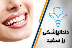 مرکز دندانپزشکی رز سفید گروه ایمپلنت، زیبایی، درمان ریشه و ... (اقساطی) - ایران جابینو