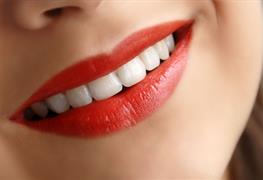 نمایش توضیحات لمینت دندان