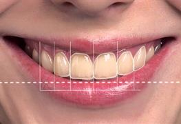 نمایش توضیحات طراحی لبخند