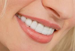 نمایش توضیحات کامپوزیت ونیر