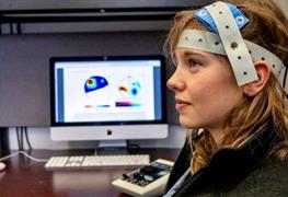 تحریک الکتریکی مغز (tDCS)