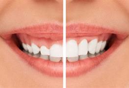 جراحی های زیبایی لثه