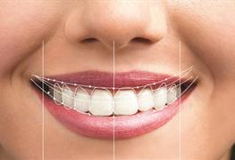 اصلاح طرح لبخند