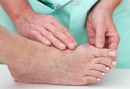 نمایش توضیحات درمان انحراف شست پا