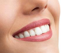 طراحی لبخند هالیودی