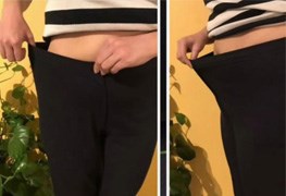 نمایش توضیحات لاغری با دستگاه ای ام اسکالپ