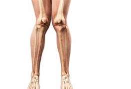 نمایش توضیحات درمان زانوی ضربدری کودکان و بزرگسالان