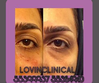 نمونه هایی از خدمات هایفوتراپی