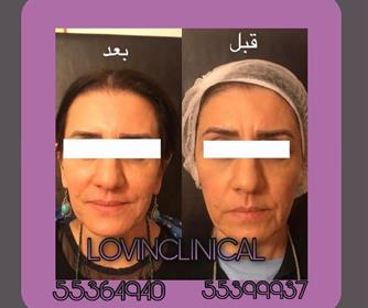 نمونه هایی از خدمات جوانسازی پوست