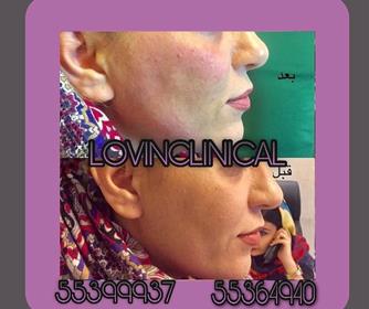 نمونه هایی از خدمات لیفت