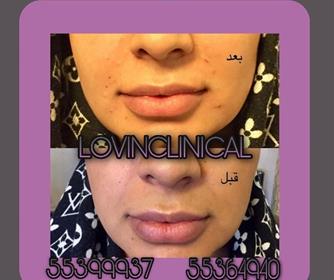 نمونه هایی از خدمات رفع خط خنده