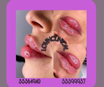 نمونه هایی از خدمات تزریق ژل