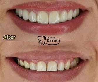 نمونه عکس هایی از طراحی طرح لبخند