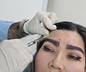 نمونه هایی از تزریق بوتاکس